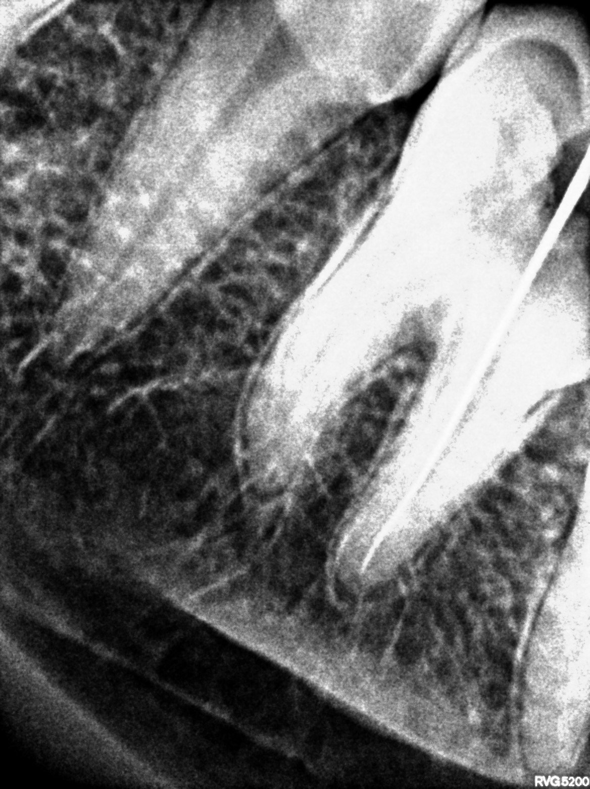 Dental X-ray